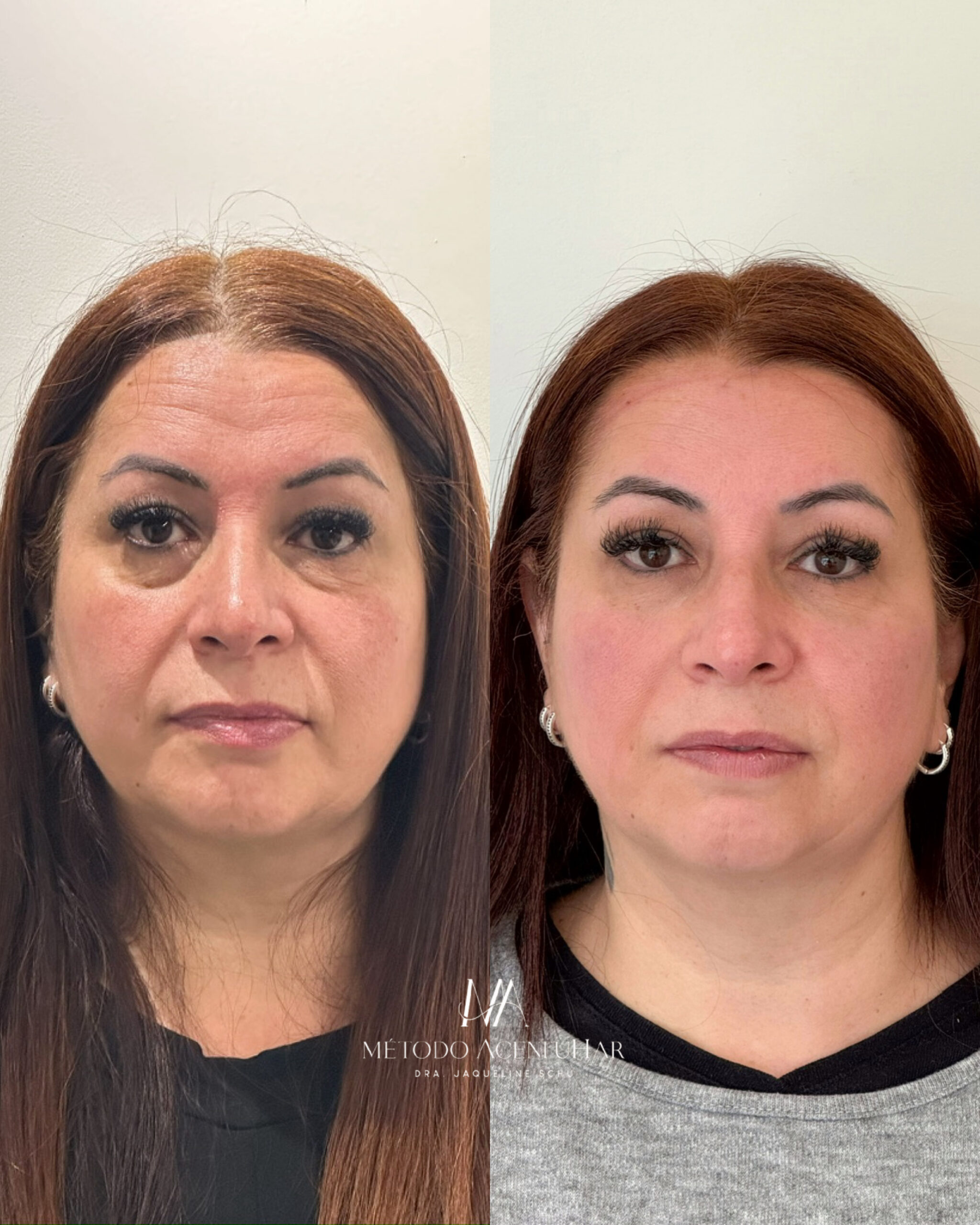 created by photogrid